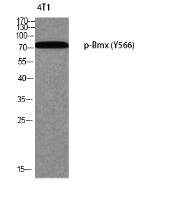 Fig. Western blot analysis of 4T1 using p-Bmx (Y566) antibody.