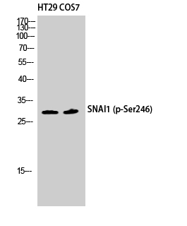 Fig. Western Blot analysis of HT29 COS7 cells using Phospho-SNAI 1 (S246) Polyclonal Antibody diluted at 1:500.