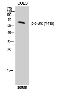 Fig. Western Blot analysis of Jurkat cells using Phospho-c-Src (Y419) Polyclonal Antibody diluted at 1:500.