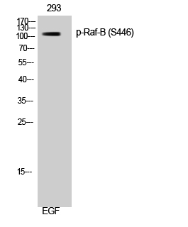 Fig.1. Western Blot analysis of 293 cells using Phospho-Raf-B (S446) Polyclonal Antibody diluted at 1:1000.