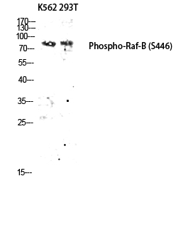Fig.2. Western blot analysis of K562 293T lysis using Phospho-Raf-B (S446) antibody. Antibody was diluted at 1:1000.