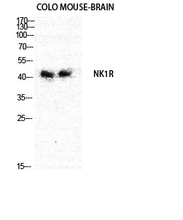 Fig. Western Blot analysis of Mouse-BRAIN COLO cells using NK-1R Polyclonal Antibody diluted at 1:1000.