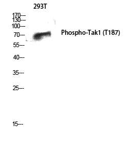 Fig. Western Blot analysis of 293T cells using Phospho-Tak1 (T187) Polyclonal Antibody diluted at 1:1000.