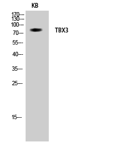 Fig.1. Western Blot analysis of KB cells using TBX3 Polyclonal Antibody diluted at 1:1000.
