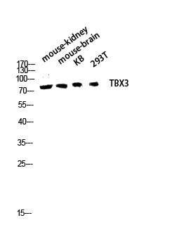 Fig.2. Western blot analysis of Mouse-kidney Mouse-brain KB 293T lysis using TBX3 antibody. Antibody was diluted at 1:1000.