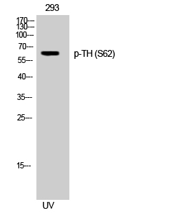 Fig. Western Blot analysis of 293 cells using Phospho-TH (S62) Polyclonal Antibody.