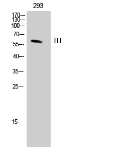 Fig. Western Blot analysis of 293 cells using TH Polyclonal Antibody.