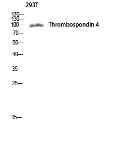 Fig. Western blot analysis of 293T lysis using Thrombospondin 4 antibody. Antibody was diluted at 1:1000.