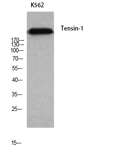 Fig. Western Blot analysis of K562 cells using Tensin-1 Polyclonal Antibody.