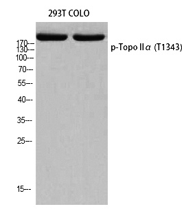 Fig. Western blot analysis of 293T COLO using p-Topo Iiα (T1343) antibody. Antibody was diluted at 1:2000.