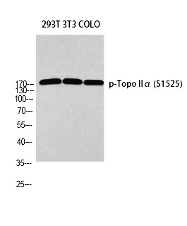 Fig. Western blot analysis of 293T 3T3 COLO using p-Topo Iiα (S1525) antibody. Antibody was diluted at 1:1000.
