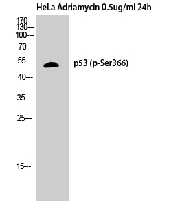 Fig. Western Blot analysis of HELA cells using Phospho-p53 (S366) Polyclonal Antibody.