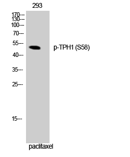 Fig. Western Blot analysis of 293 cells using Phospho-TPH1 (S58) Polyclonal Antibody.