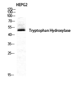 Fig. Western Blot analysis of HepG2 cells using TPH1 Polyclonal Antibody diluted at 1:500. Secondary antibody was diluted at 1:20000.