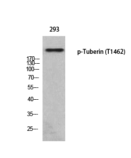 Fig. Western blot analysis of 293 using p-Tuberin (T1462) antibody.