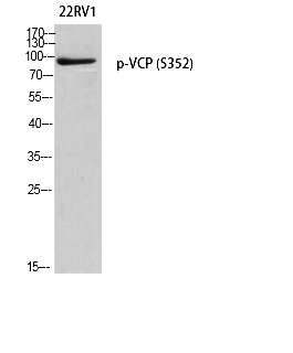 Fig. Western blot analysis of 22RV1 using p-VCP (S352) antibody. Antibody was diluted at 1:1000.