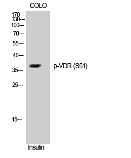 Fig. Western Blot analysis of COLO cells using Phospho-VDR (S51) Polyclonal Antibody.