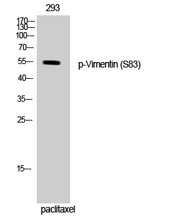 Fig. Western Blot analysis of 293 cells using Phospho-Vimentin (S83) Polyclonal Antibody.