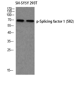 Fig. Western blot analysis of SH-SY5Y 293T using p-Splicing factor 1 (S82) antibody. Antibody was diluted at 1:500.