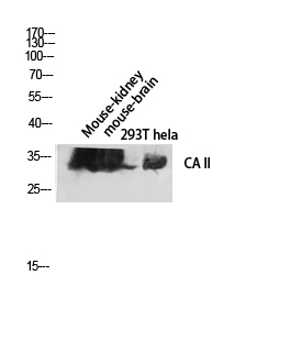 Fig. Western blot analysis of Mouse-kidney Mouse-brain 293T hela lysis using CA II antibody. Antibody was diluted at 1:2000.