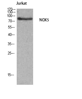 Fig. Western Blot analysis of Jurkat cells using Nox5 Polyclonal Antibody.