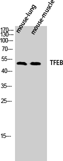 Fig.1. Western Blot analysis of Mouse-lung Mouse-muscle cells using TFEB Polyclonal Antibody diluted at 1:500.