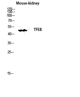 Fig.2. Western blot analysis of Mouse-kidney lysis using TFEB antibody. Antibody was diluted at 1:500.