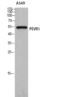 Fig. Western Blot analysis of A549 cells using GPR172A Polyclonal Antibody.