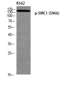 Fig. Western blot analysis of K562 using p-SMC1 (S966) antibody.