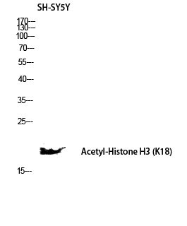 Fig. Western blot analysis of SH-SY5Y lysis using Acetyl-Histone H3 (K18) antibody. Antibody was diluted at 1:1000. Secondary antibody was diluted at 1:20000.