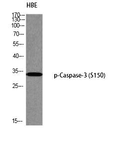 Fig. Western blot analysis of HBE using p-Caspase-3 (S150) antibody. Antibody was diluted at 1:1000.