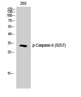 Fig. Western Blot analysis of Jurkat cells using Phospho-Caspase-6 (S257) Polyclonal Antibody diluted at 1:1000.