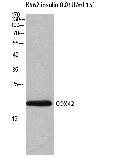 Fig. Western Blot analysis of K562 insulin 0.01U/ml 15' cells using COX4I2 Polyclonal Antibody.