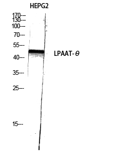 Fig.1. Western Blot analysis of HEPG2 using LPAAT-θ Polyclonal Antibody diluted at 1:1000.