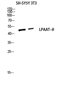 Fig.2. Western blot analysis of SH-SY5Y 3T3 lysis using LPAAT-θ antibody. Antibody was diluted at 1:1000.