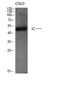 Fig. Western Blot analysis of Colo using Antibody diluted at 1:1000. Secondary antibody was diluted at 1:20000.