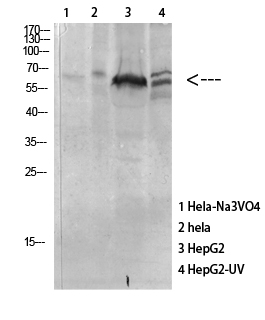 Fig. Western Blot analysis of various cells using Antibody diluted at 1:1000. Secondary antibody was diluted at 1:20000.