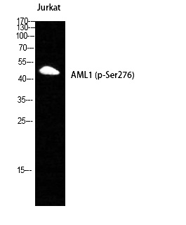 Fig. Western Blot analysis of Jurkat cells using Phospho-RUNX1 (S249) Polyclonal Antibody.