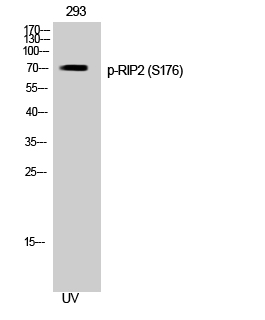 Fig. Western Blot analysis of 293 cells using Phospho-RIP2 (S176) Polyclonal Antibody.