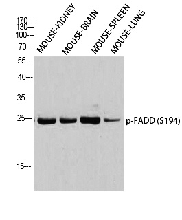 Fig. Western blot analysis of Mouse-KIDNEY Mouse-BRAIN Mouse-SPLEEN Mouse-LUNG using p-FADD (S194) antibody. Antibody was diluted at 1:1000.