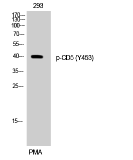 Fig. Western Blot analysis of 293 cells using Phospho-CD5 (Y453) Polyclonal Antibody.
