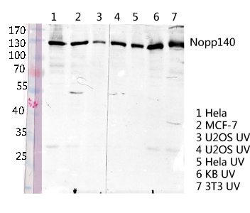 Fig. Western blot analysis of various lysis using Nopp140 Polyclonal Antibody diluted at 1:2000. Secondary antibody was diluted at 1:20000.