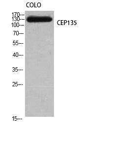 Fig.1. Western Blot analysis of COLO cells using CEP135 Polyclonal Antibody diluted at 1:1000.
