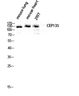 Fig.2. Western blot analysis of Mouse-lung Mouse-heart 293T lysis using CEP135 antibody. Antibody was diluted at 1:1000.