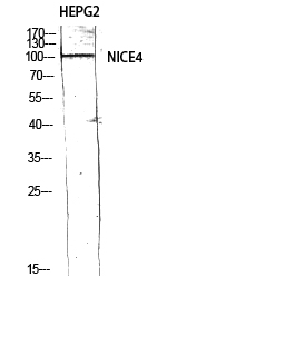 Fig.2. Western Blot analysis of HEPG2 using NICE4 Polyclonal Antibody diluted at 1:500.