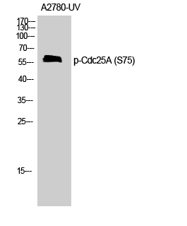 Fig. Western Blot analysis of Jurkat cells using Phospho-Cdc25A (S75) Polyclonal Antibody.