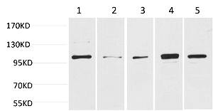 Fig.1. Western blot analysis of 1) Hela, 2) 293T, 3) Mouse Skeletal Muscle, 4) Rat Kidney, 5) Rat Skeletal Muscle using ERK 5 Polyclonal Antibody. Secondary antibody (catalog#: A21020) was diluted at 1:20000.