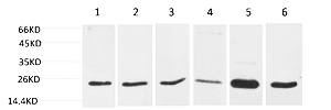 Fig.1. Western blot analysis of 1) 293T, 2) Hela, 3) C2C12,  4) 3T3, 5) Rat Liver Tissue, 6) Rat Brain Tissue using SOD2 Polyclonal Antibody. Secondary antibody (catalog#: A21020) was diluted at 1:20000.