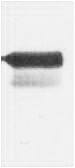 Fig. Western blot analysis of Recombinant AD protein using GAL4 Activation Domain Polyclonal Antibody. Secondary antibody (catalog#: A21020) was diluted at 1:20000.