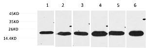 Fig.1. Western blot analysis of 1) Hela, 2) HepG2,  3) C2C12,  4) Mouse Liver Tissue, 5) Rat Brain Tissue, 6) Rat Liver Tissue using SOD2 Polyclonal Antibody. Secondary antibody (catalog#: A21020) was diluted at 1:20000.